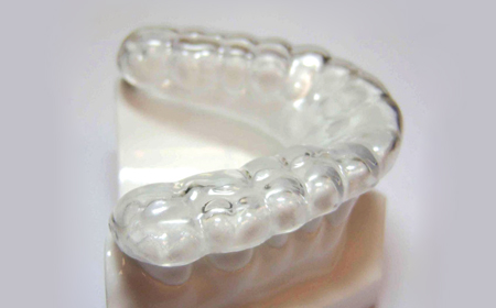 m&aacute;ng chống nghiến