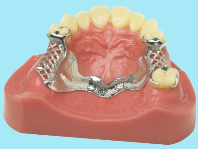 nền h&agrave;m sử dụng titanium